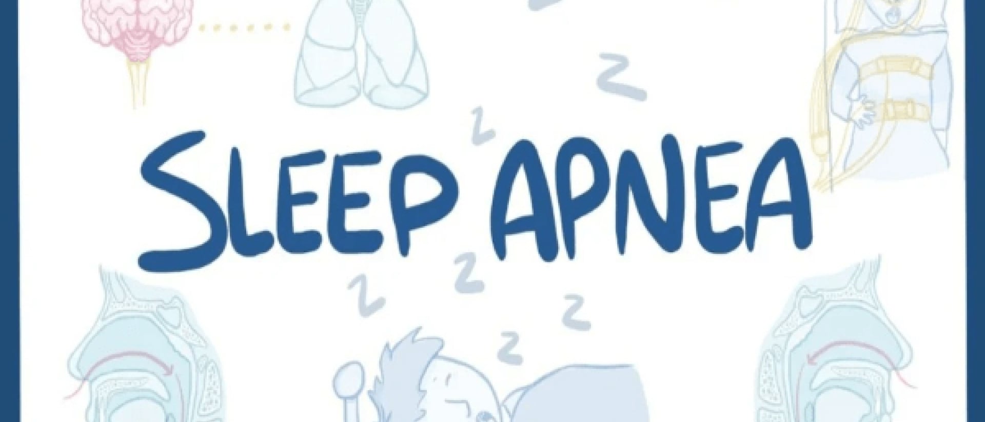 man with sleep apnea